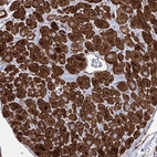 Immunohistochemical staining of human Heart muscle shows strong cytoplasmic and membranous positivity in cardiomyocytes.