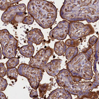 Immunohistochemical staining of human placenta shows strong positivity in microvilli in trophoblastic cells.