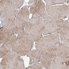 Immunohistochemical staining of human Skeletal muscle shows moderate cytoplasmic positivity in myocytes.