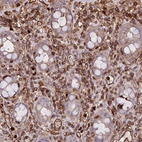 Immunohistochemical staining of human rectum shows strong membranous positivity in lymphoid cells.