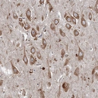 Anti-SRPX2 Antibody