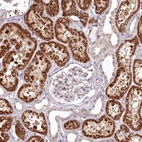 Anti-ADRA1D Antibody