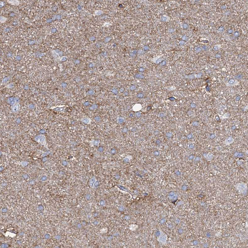 Anti-PRSS35 Antibody