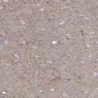 Anti-PRSS35 Antibody