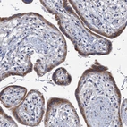Immunohistochemical staining of human placenta shows strong cytoplasmic positivity in trophoblastic cells.