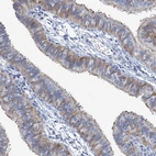 Immunohistochemical staining of human fallopian tube shows moderate cytoplasmic positivity in glandular cells.