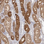 Anti-PNISR Antibody