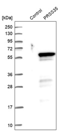Anti-PRSS35 Antibody