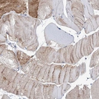 Immunohistochemical staining of human skeletal muscle shows moderate cytoplasmic positivity in myocytes.