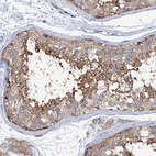 Anti-TRIM55 Antibody