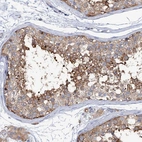 Immunohistochemical staining of human testis shows moderate cytoplasmic positivity in cells in seminiferous ducts.