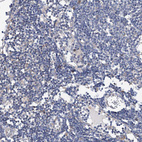 Anti-TRIM55 Antibody