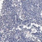 Immunohistochemical staining of human lymph node shows no positivity in non-germinal center cells as expected.