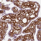 Immunohistochemical staining of human placenta shows strong positivity in extracellular matrix in chorionic vlli.