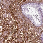 Immunohistochemical staining of human prostate shows strong membranous positivity in smooth muscle cells.