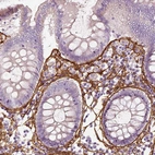 Immunohistochemical staining of human colon shows strong positivity in extracellular matrix in lamina propria.