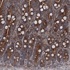 Anti-RUFY1 Antibody