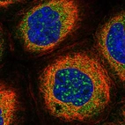 Immunofluorescent staining of human cell line A-431 shows localization to nuclear speckles & cytosol.