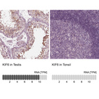 Anti-KIF6 Antibody