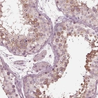 Immunohistochemical staining of human testis shows high expression.