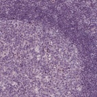 Immunohistochemical staining of human tonsil shows low expression as expected.