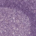 Immunohistochemical staining of human tonsil shows low expression as expected.