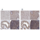 Anti-PSMD4 Antibody