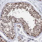 Immunohistochemical staining of human testis shows moderate cytoplasmic and nuclear positivity in cells in seminiferous ducts.