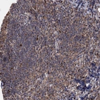 Immunohistochemical staining of human tonsil shows moderate cytoplasmic and nuclear positivity in germinal center cells.
