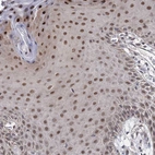 Immunohistochemical staining of human skin shows strong nuclear positivity in squamous epithelial cells.