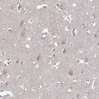 Anti-ARHGAP44 Antibody