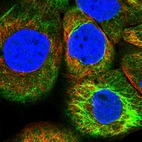 Immunofluorescent staining of human cell line A-431 shows localization to cytosol & intermediate filaments.