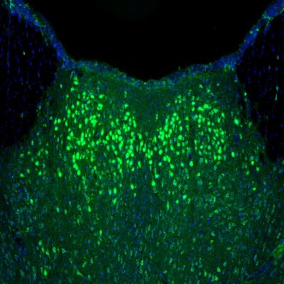 Anti-NAGLU Antibody