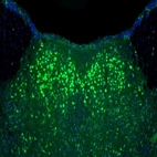Anti-NAGLU Antibody