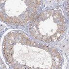 Immunohistochemical staining of human testis shows moderate cytoplasmic positivity in cells in seminiferous ducts.