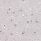 Immunohistochemical staining of human lateral ventricle shows cytoplasmic positivity in neurons.