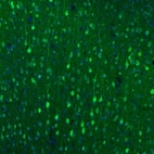 Immunofluorescence staining of mouse motor cortex shows immunoreactivity in neuronal cell bodies and dendrites.