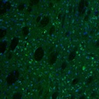 Immunofluorescence staining of mouse caudate putamen shows immunoreactivity in neurons.