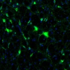 Immunofluorescence staining of mouse midbrain shows neuronal positivity in the reticular nucleus.