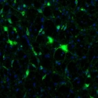 Immunofluorescence staining of mouse midbrain shows neuronal positivity in the reticular nucleus.