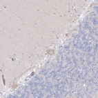Immunohistochemical immunoreactivity shows weak cytoplasmic positivity in Purkinje cells.
