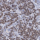 Anti-BRINP1 Antibody