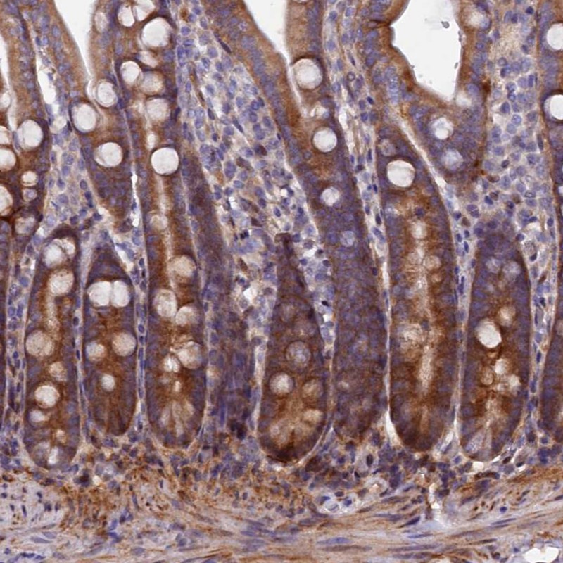 Anti-PDZRN3 Antibody