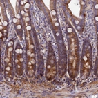 Anti-PDZRN3 Antibody