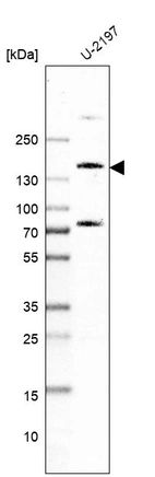 Western blot analysis in human cell line U-2197.