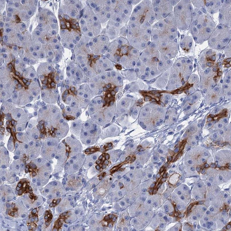 Anti-FAAP20 Antibody