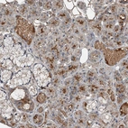 Immunohistochemical staining of human salivary gland shows strong membranous positivity in glandular cells.