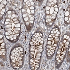 Immunohistochemical staining of human recum shows moderate membranous positivity in glandular cells.