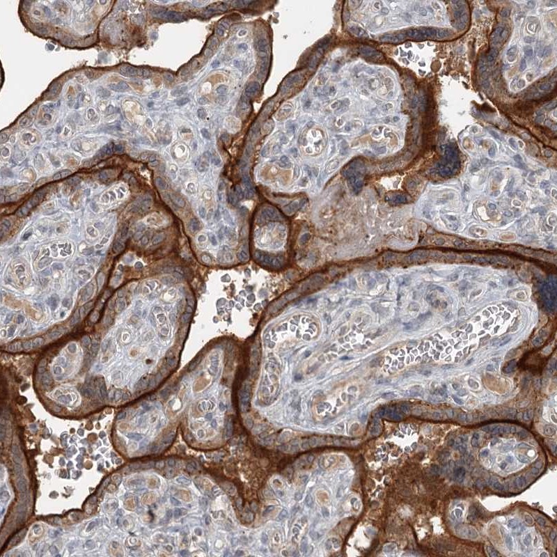 Anti-SLC39A8 Antibody