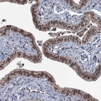 Immunohistochemical staining of human Fallopian tube shows moderate to strong nuclear positivity in glandular cells.